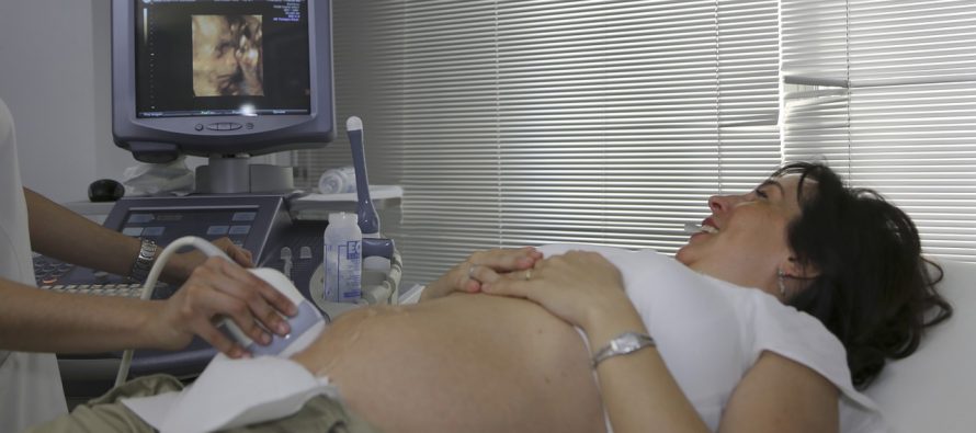 Šta je ekspertni ultrazvuk i kada se radi?